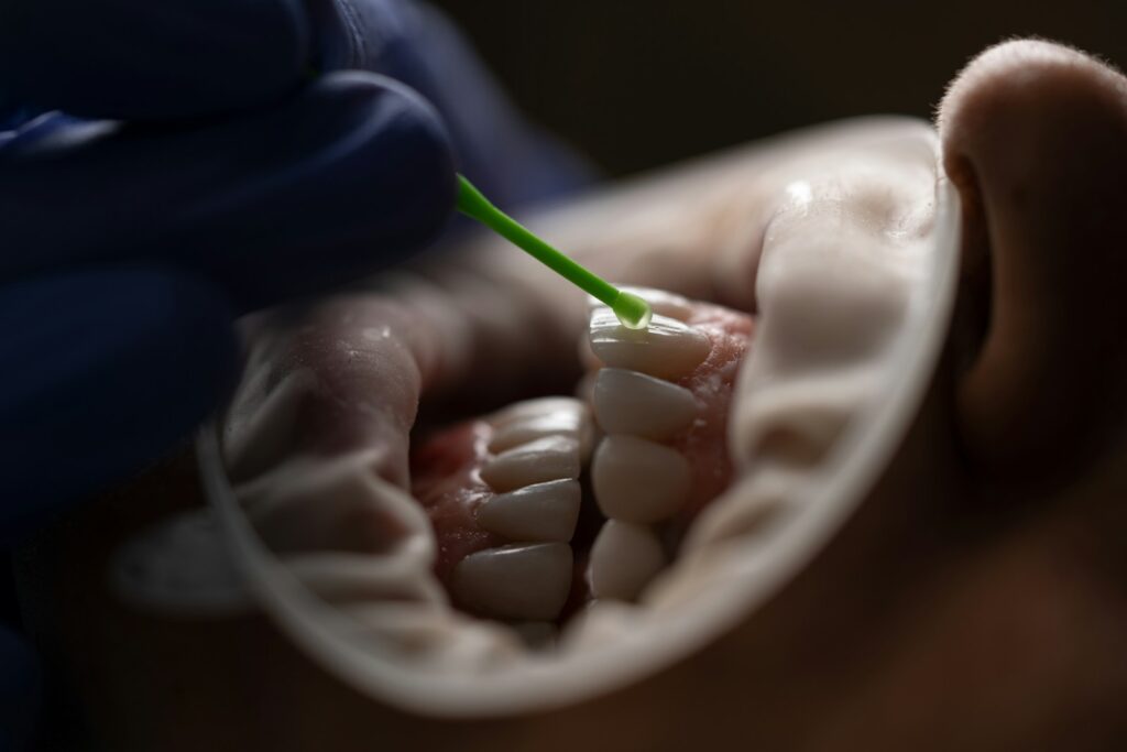 Tooth gems: jak zrobić &#8211; przewodnik do zdobienia zębów